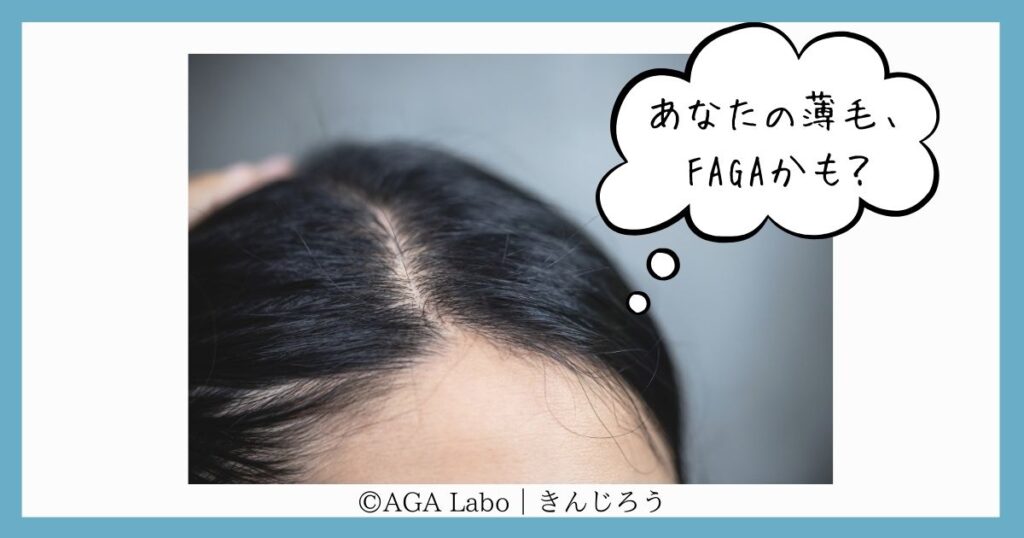 Could-it-be-FAGA?
